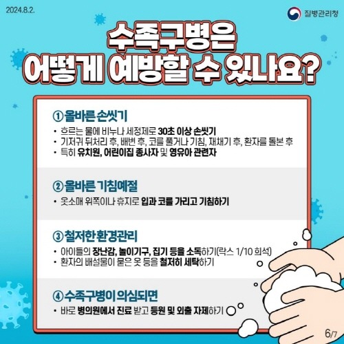 5. 이천시 예방수칙 준수 및 위생관리 주의 당부 영유아 수족구병 증가 추세3.jpg